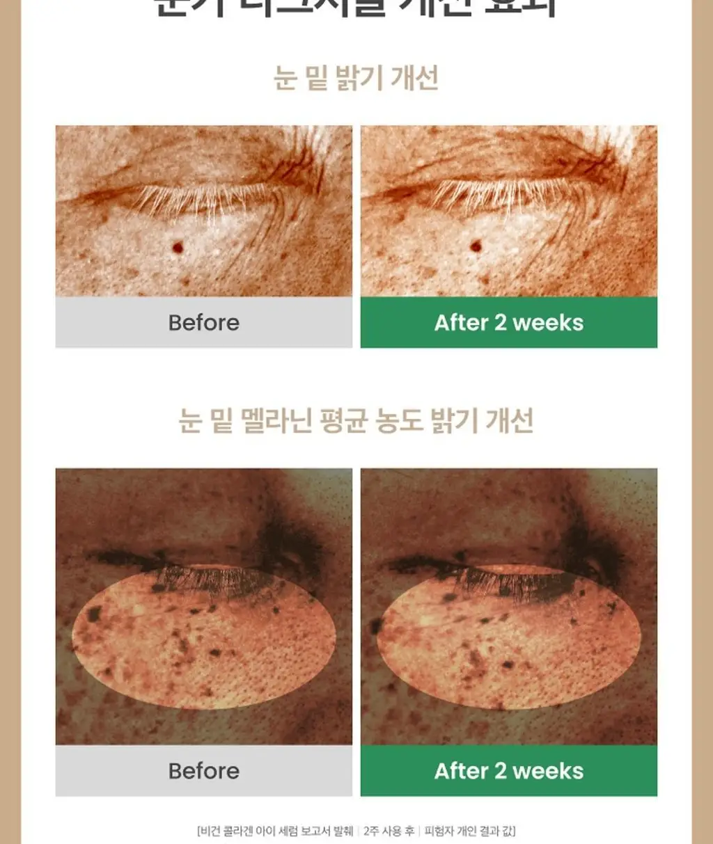 [탱탱아이볼세럼/탄력] 엑시스와이 비건 콜라겐 아이세럼 10ml 상세페이지 10